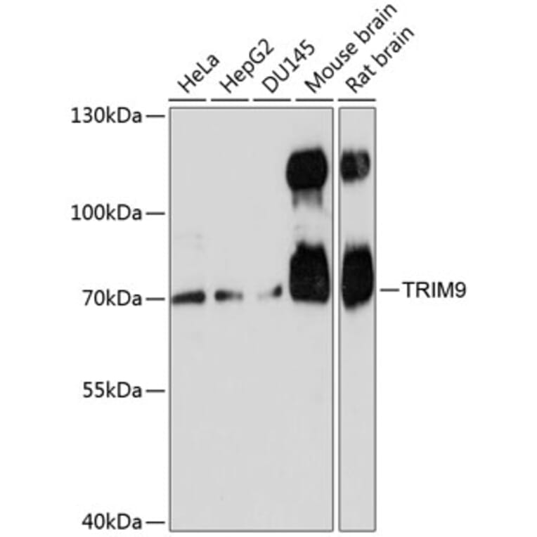 Western Blot - Anti-TRIM9 Antibody (A91208) - Antibodies.com