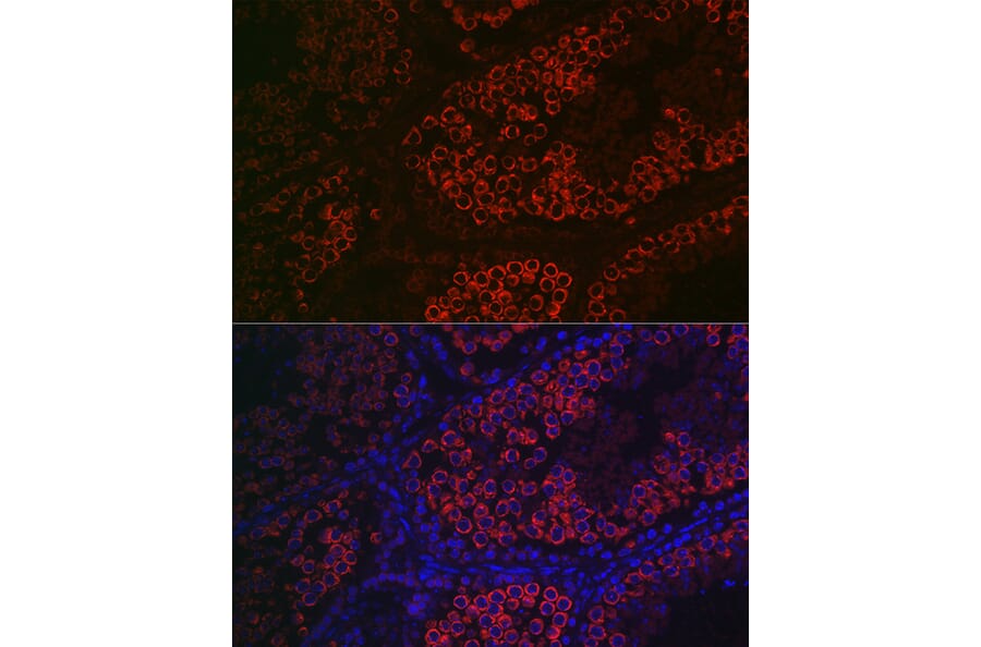 Immunofluorescence - Anti-DDX4/MVH Antibody (A91209) - Antibodies.com