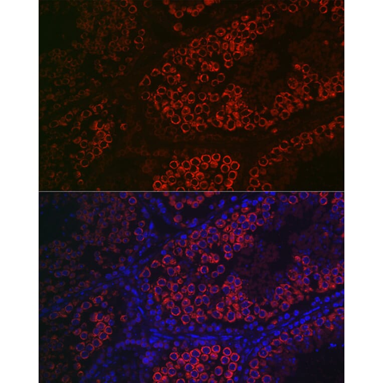 Immunofluorescence - Anti-DDX4/MVH Antibody (A91209) - Antibodies.com