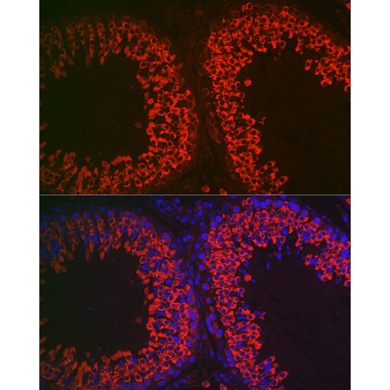 Immunofluorescence - Anti-DDX4/MVH Antibody (A91209) - Antibodies.com