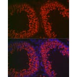 Immunofluorescence - Anti-DDX4/MVH Antibody (A91209) - Antibodies.com
