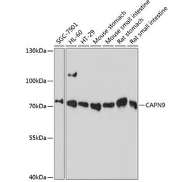 Western Blot - Anti-Calpain 9 Antibody (A91210) - Antibodies.com