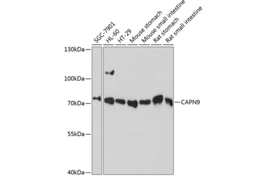 Western Blot - Anti-Calpain 9 Antibody (A91210) - Antibodies.com