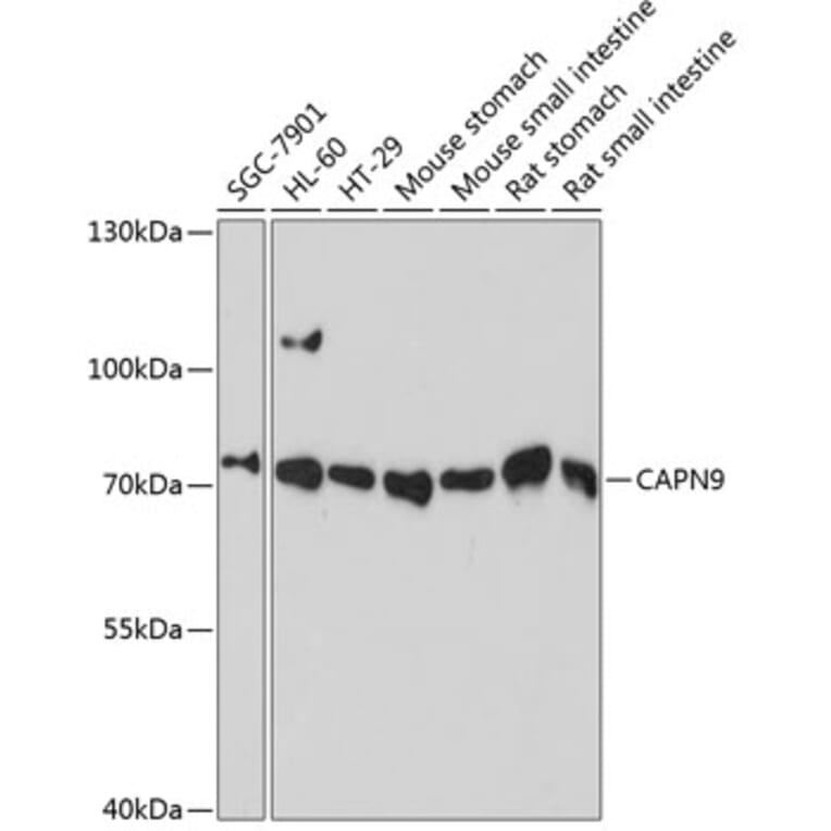 Western Blot - Anti-Calpain 9 Antibody (A91210) - Antibodies.com