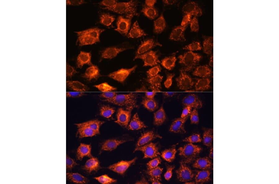 Immunofluorescence - Anti-PTCD1 Antibody (A91211) - Antibodies.com