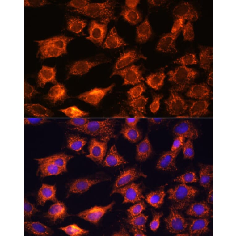 Immunofluorescence - Anti-PTCD1 Antibody (A91211) - Antibodies.com