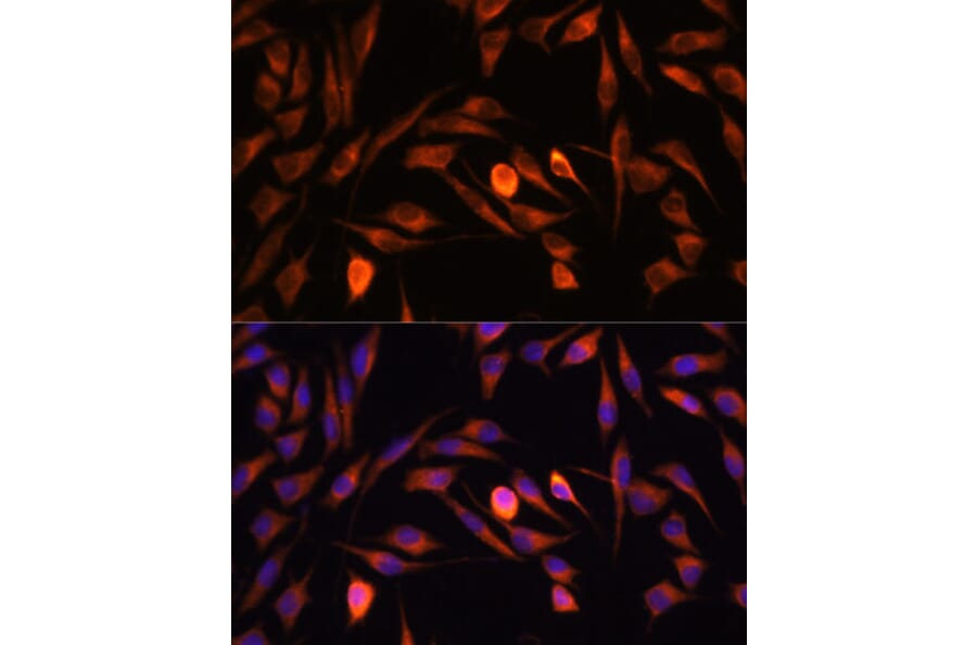 Immunofluorescence - Anti-PTCD1 Antibody (A91211) - Antibodies.com