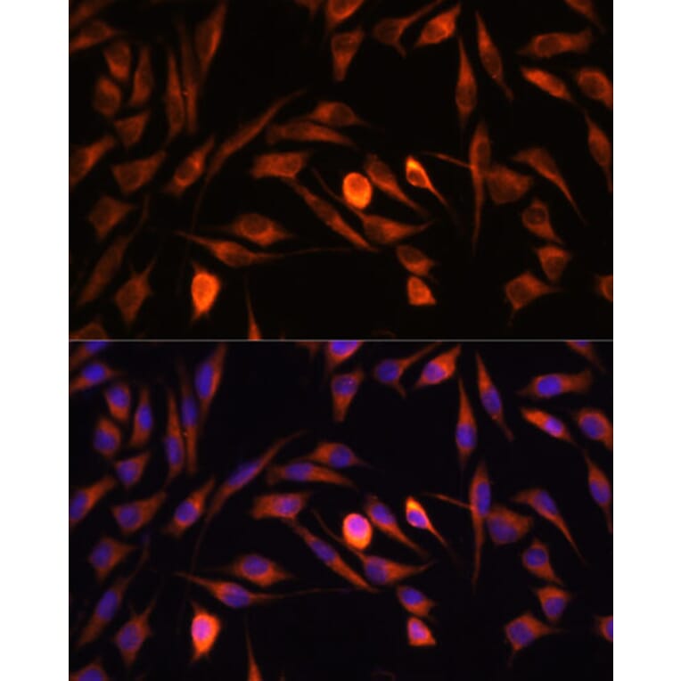 Immunofluorescence - Anti-PTCD1 Antibody (A91211) - Antibodies.com