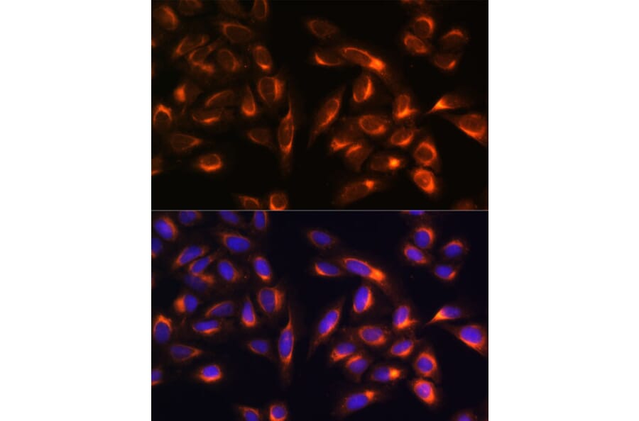Immunofluorescence - Anti-PTCD1 Antibody (A91211) - Antibodies.com