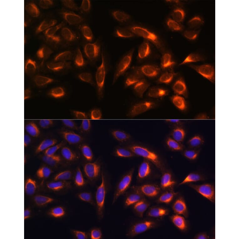 Immunofluorescence - Anti-PTCD1 Antibody (A91211) - Antibodies.com