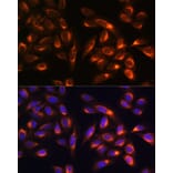 Immunofluorescence - Anti-PTCD1 Antibody (A91211) - Antibodies.com