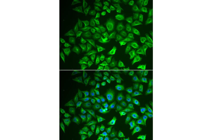 Immunofluorescence - Anti-EHHADH Antibody (A91212) - Antibodies.com