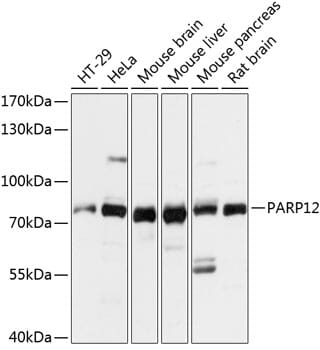 Western blot analysis of extracts of various cell lines, using Anti-PARP12 Antibody (A14317) at 1:3000 dilution.
Secondary antibody: Goat Anti-Rabbit IgG (H+L) (HRP) (AS014) at 1:10,000 dilution.
Lysates / proteins: 25µg per lane.
Blocking buffer: 3% non-fat dry milk in TBST.
Detection: ECL Basic Kit (RM00020).
Exposure time: 10s.