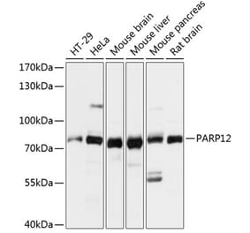 Western Blot - Anti-PARP12 Antibody (A91213) - Antibodies.com