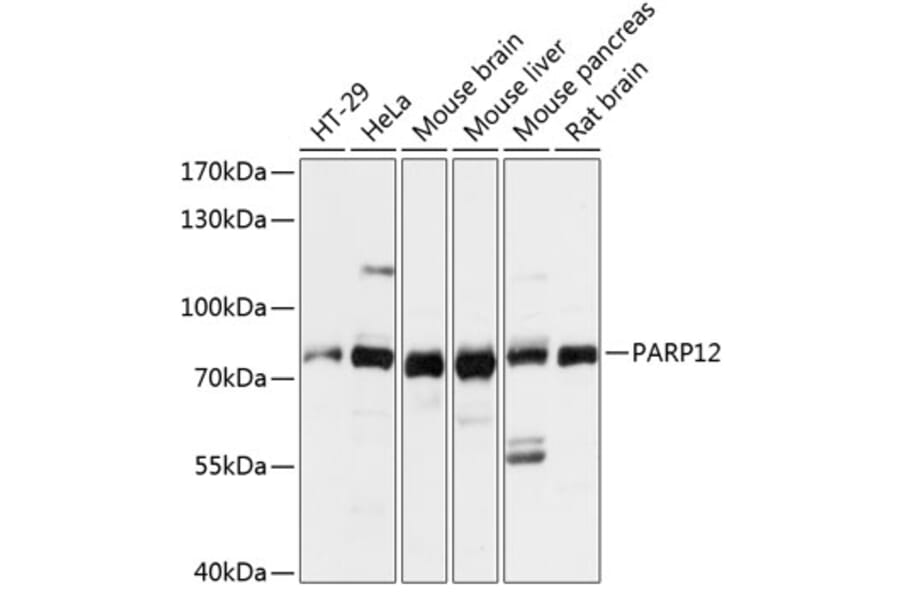 Western Blot - Anti-PARP12 Antibody (A91213) - Antibodies.com