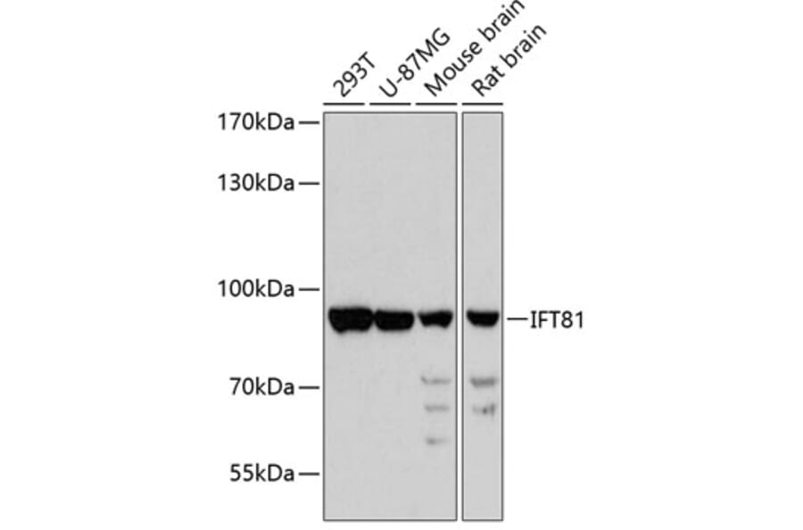 Western Blot - Anti-IFT81 Antibody (A91214) - Antibodies.com
