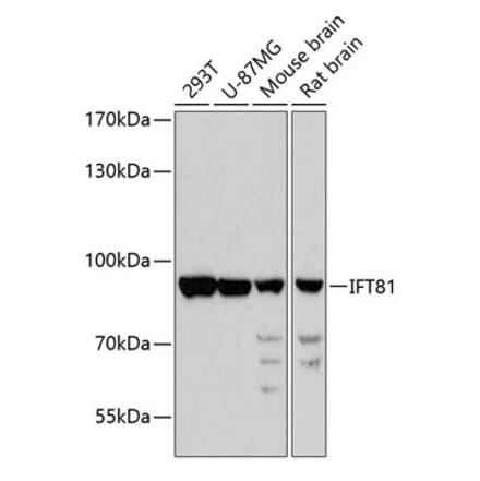 Western Blot - Anti-IFT81 Antibody (A91214) - Antibodies.com