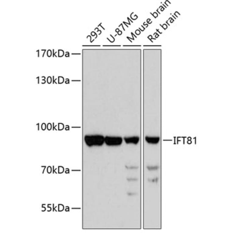 Western Blot - Anti-IFT81 Antibody (A91214) - Antibodies.com
