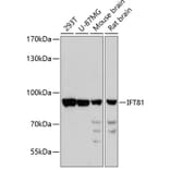 Western Blot - Anti-IFT81 Antibody (A91214) - Antibodies.com
