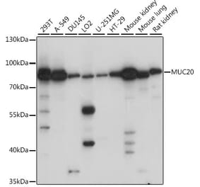 Western Blot - Anti-MUC20 Antibody (A91216) - Antibodies.com