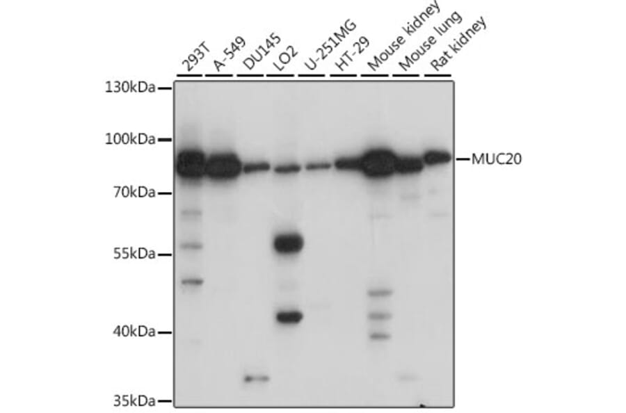 Western Blot - Anti-MUC20 Antibody (A91216) - Antibodies.com