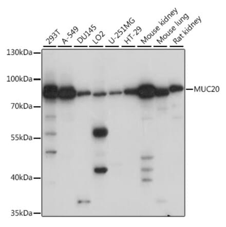 Western Blot - Anti-MUC20 Antibody (A91216) - Antibodies.com