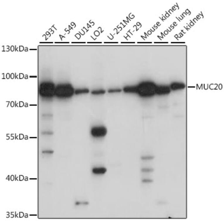 Western Blot - Anti-MUC20 Antibody (A91216) - Antibodies.com