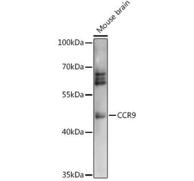 Western Blot - Anti-CCR9 Antibody (A91217) - Antibodies.com