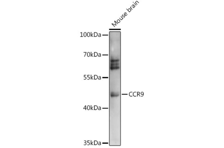Western Blot - Anti-CCR9 Antibody (A91217) - Antibodies.com