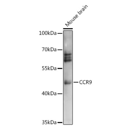 Western Blot - Anti-CCR9 Antibody (A91217) - Antibodies.com