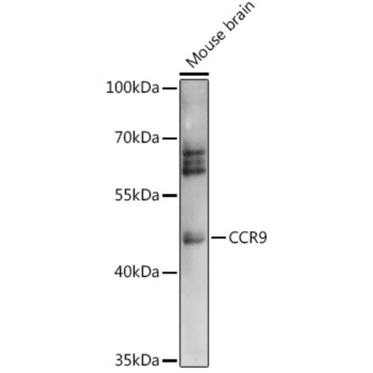 Western Blot - Anti-CCR9 Antibody (A91217) - Antibodies.com