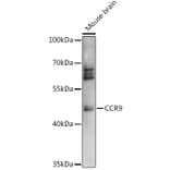 Western Blot - Anti-CCR9 Antibody (A91217) - Antibodies.com