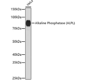 Western Blot - Anti-Alkaline Phosphatase, Tissue Non-Specific Antibody (A91218) - Antibodies.com