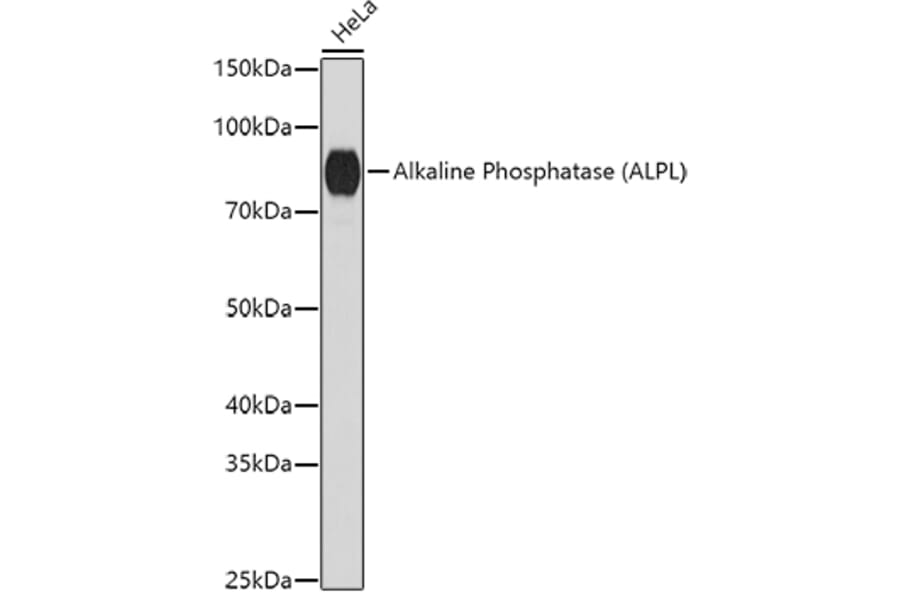 Western Blot - Anti-Alkaline Phosphatase, Tissue Non-Specific Antibody (A91218) - Antibodies.com