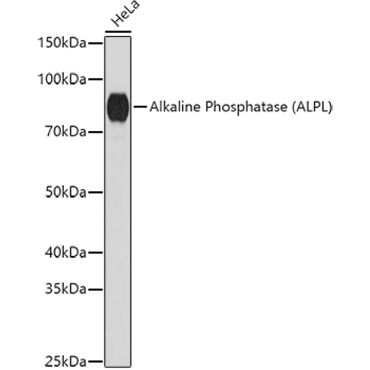 Western Blot - Anti-Alkaline Phosphatase, Tissue Non-Specific Antibody (A91218) - Antibodies.com