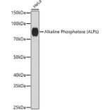 Western Blot - Anti-Alkaline Phosphatase, Tissue Non-Specific Antibody (A91218) - Antibodies.com