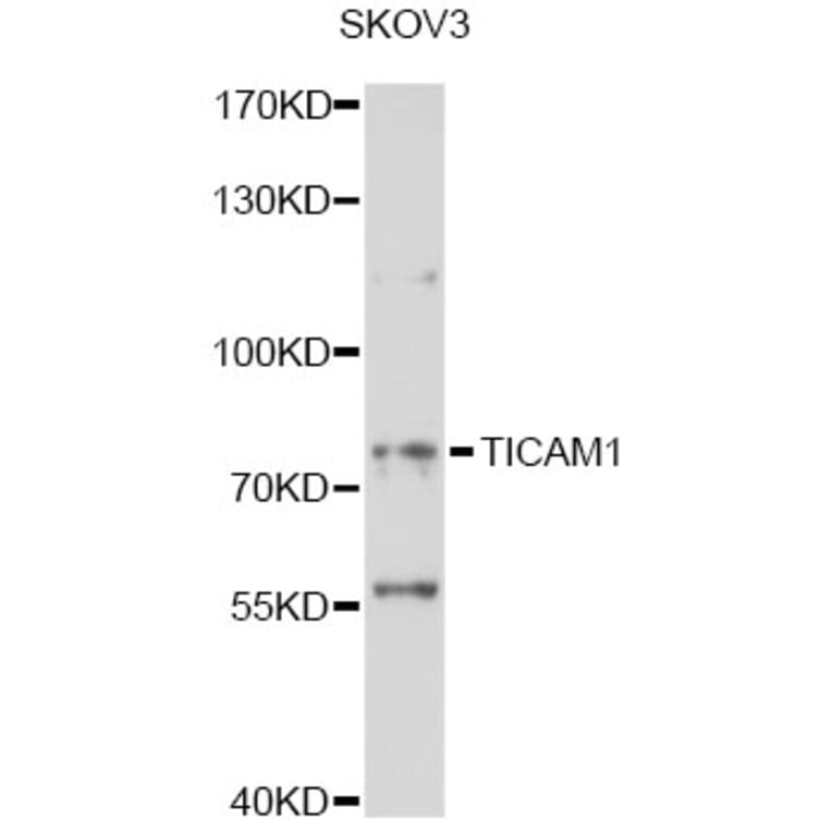 Western Blot - Anti-TICAM1 Antibody (A14162) - Antibodies.com