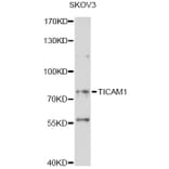 Western Blot - Anti-TICAM1 Antibody (A14162) - Antibodies.com