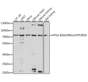 Western Blot - Anti-PPP2R5D Antibody (A91220) - Antibodies.com