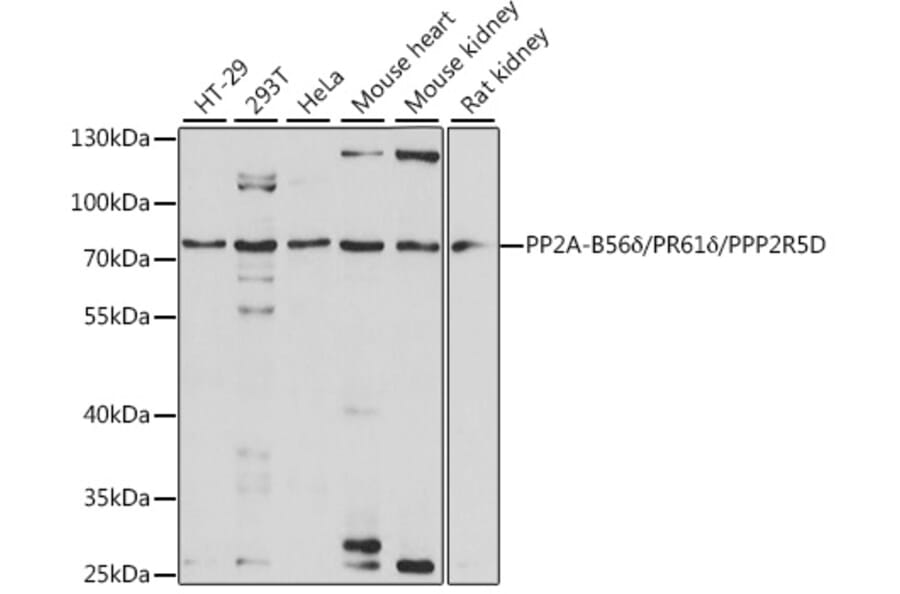 Western Blot - Anti-PPP2R5D Antibody (A91220) - Antibodies.com