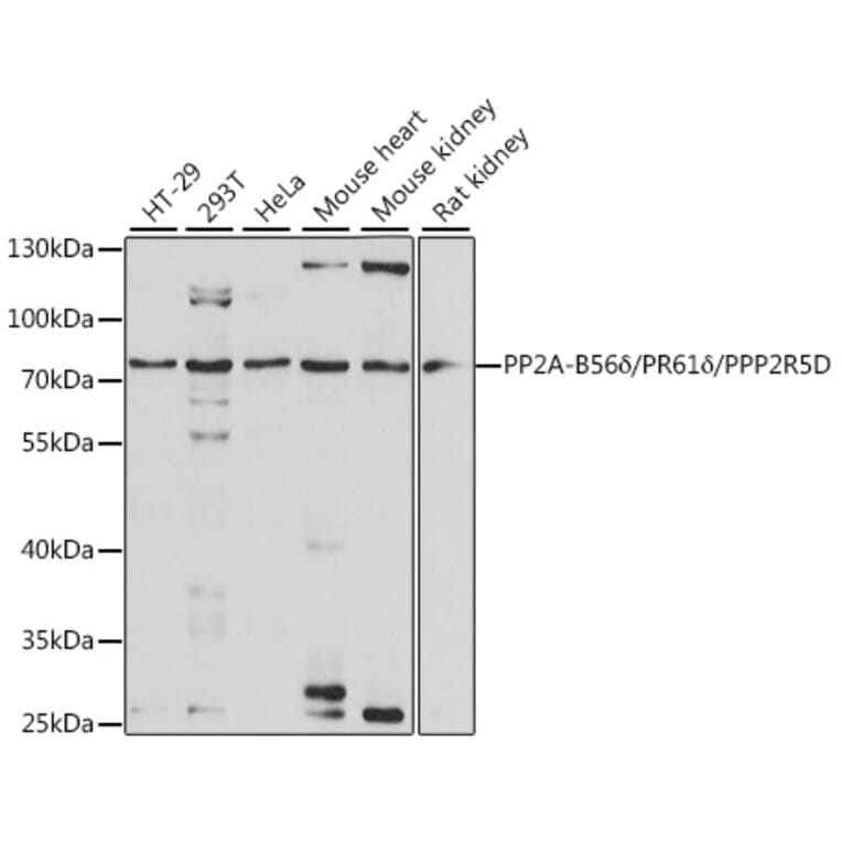 Western Blot - Anti-PPP2R5D Antibody (A91220) - Antibodies.com