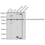 Western Blot - Anti-PPP2R5D Antibody (A91220) - Antibodies.com