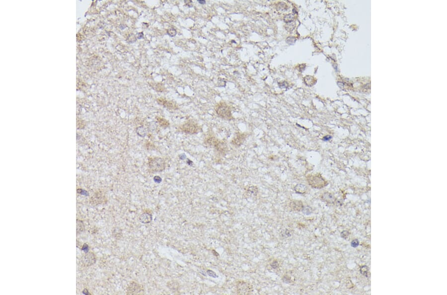 Immunohistochemistry - Anti-PPP2R5D Antibody (A91220) - Antibodies.com