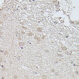 Immunohistochemistry - Anti-PPP2R5D Antibody (A91220) - Antibodies.com