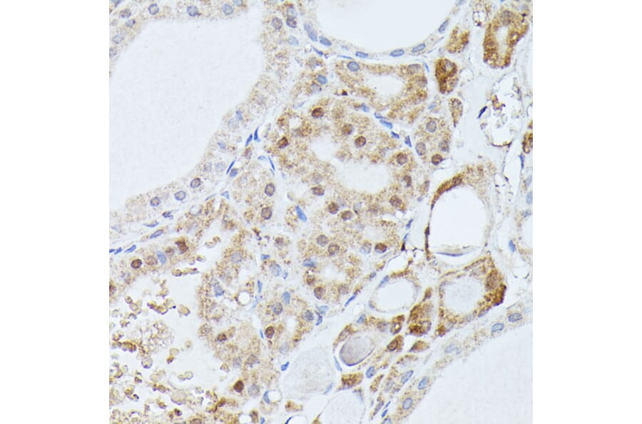 Immunohistochemistry - Anti-PPP2R5D Antibody (A91220) - Antibodies.com