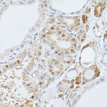 Immunohistochemistry - Anti-PPP2R5D Antibody (A91220) - Antibodies.com