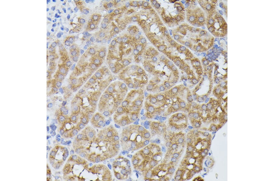 Immunohistochemistry - Anti-PPP2R5D Antibody (A91220) - Antibodies.com