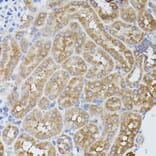 Immunohistochemistry - Anti-PPP2R5D Antibody (A91220) - Antibodies.com