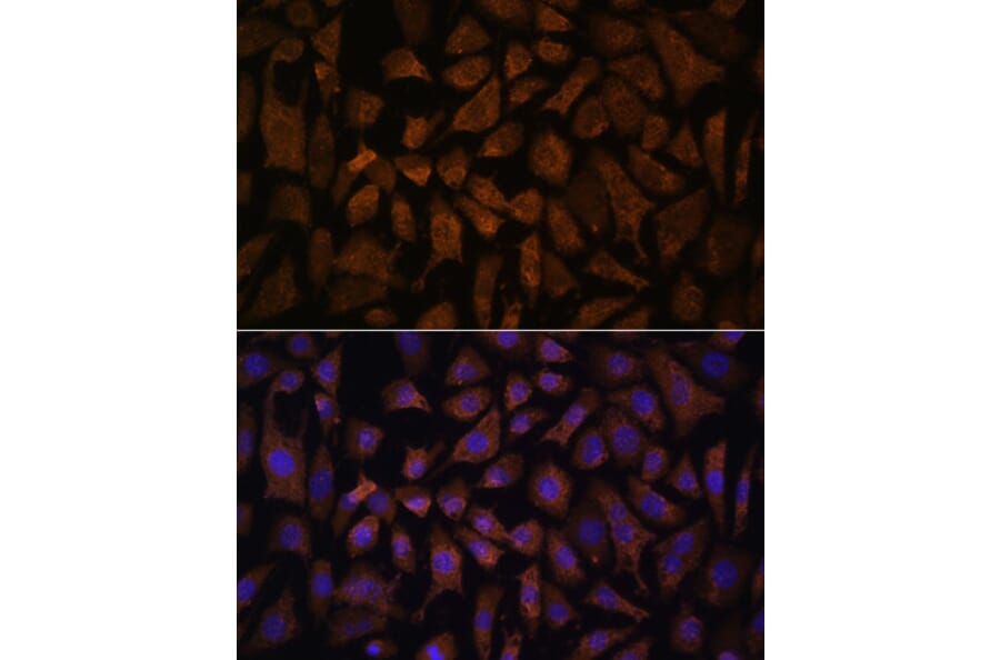 Immunofluorescence - Anti-PPP2R5D Antibody (A91220) - Antibodies.com