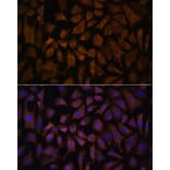 Immunofluorescence - Anti-PPP2R5D Antibody (A91220) - Antibodies.com